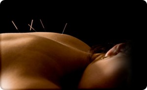 Acupuncture - For better health